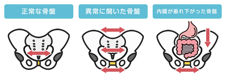 産後の骨盤